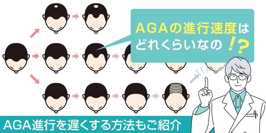 AGAの進行速度はどのくらい？進行を遅くする方法もご紹介