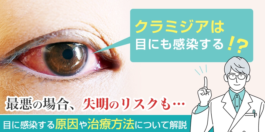 クラミジアは目にも感染する！その原因や治療方法について解説