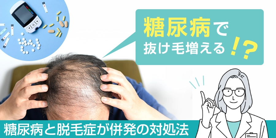 糖尿病になると抜け毛が増えるはホント？糖尿病と脱毛症が併発した時の対処法は？