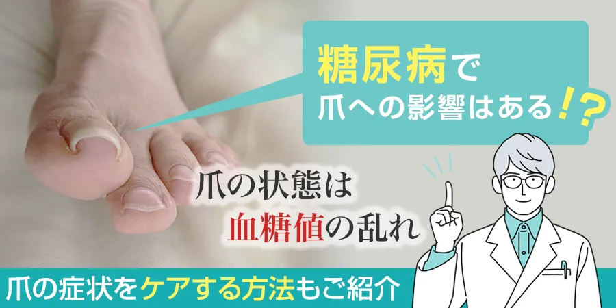 糖尿病により爪に生じる症状とは？症状をケアする方法もご紹介