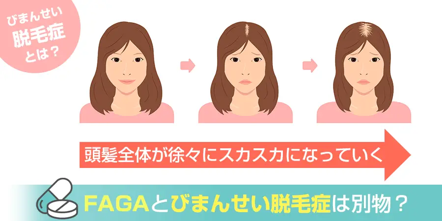 FAGAとびまん性脱毛症は別物？その違いを詳しく紹介します