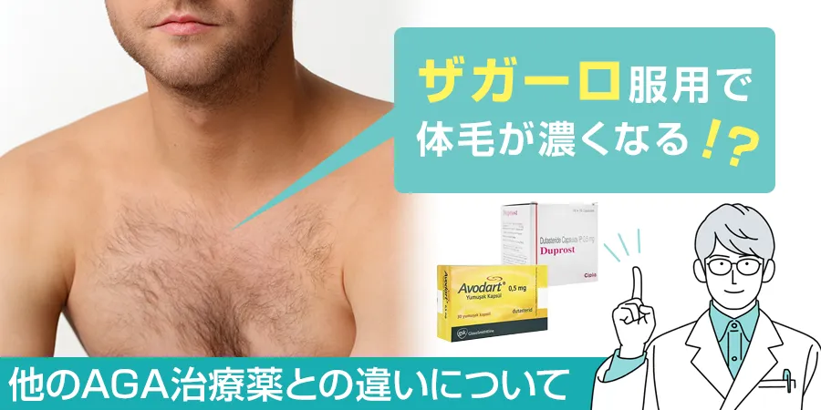 ザガーロを服用すると体毛が濃くなるの？ほかのAGA治療薬との違いについて