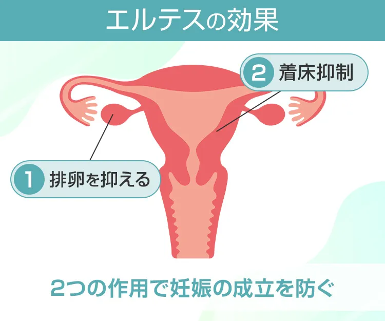 エルテス3