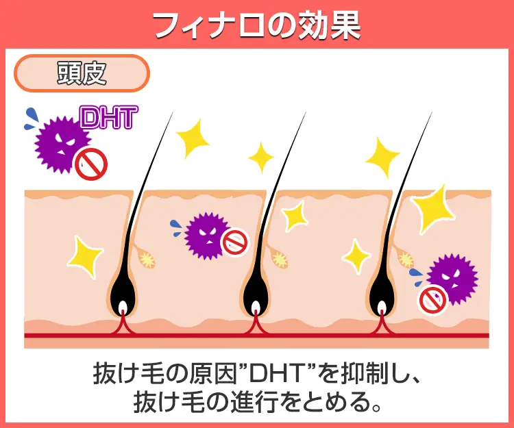 フィナロ6