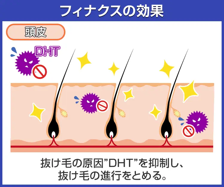 フィナクス3