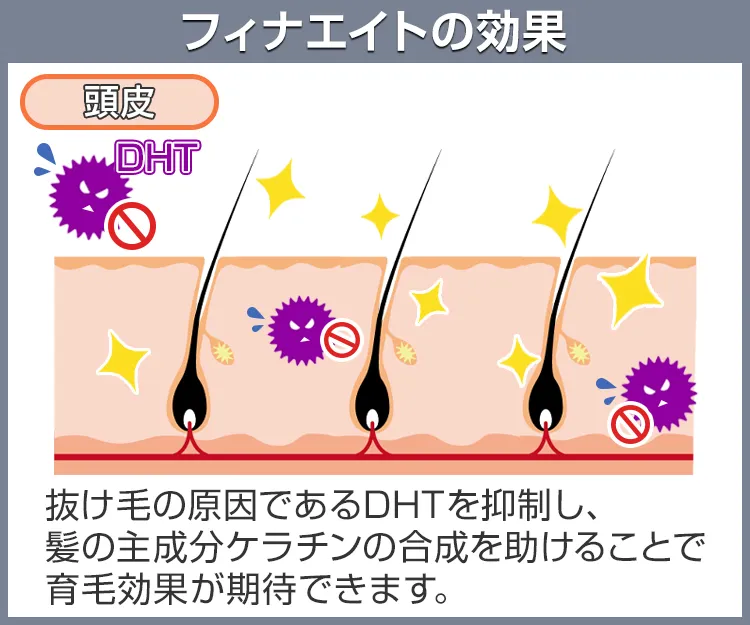 フィナエイト7