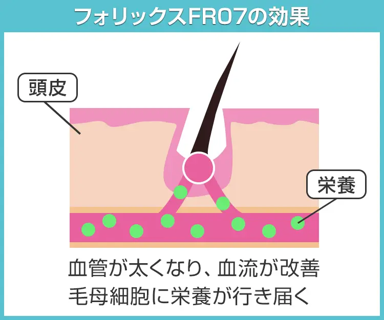 フォリックスFR073
