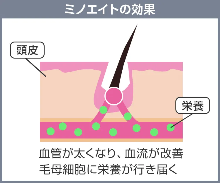 ミノエイト7