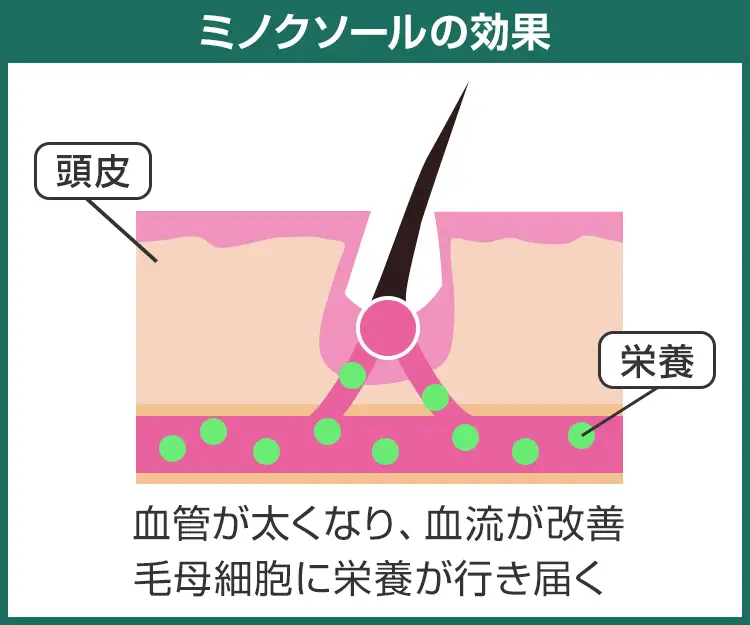 ミノクソール3