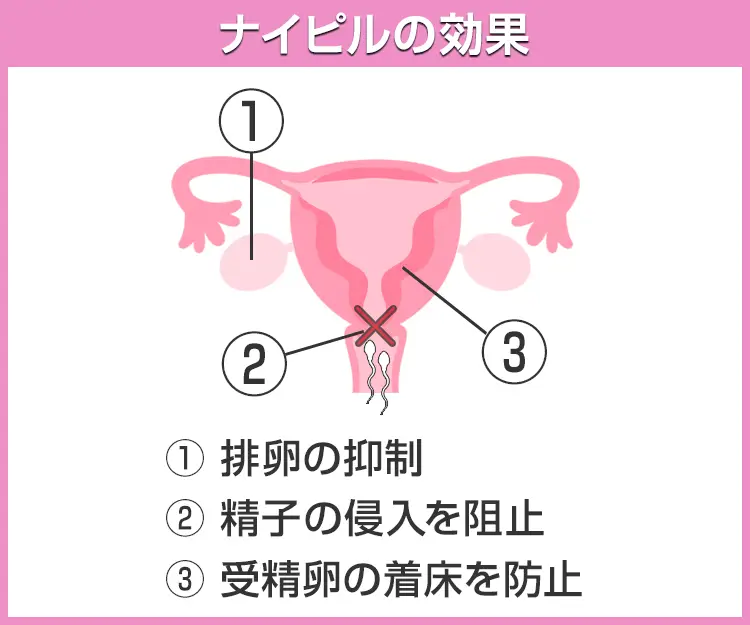 ナイピル4