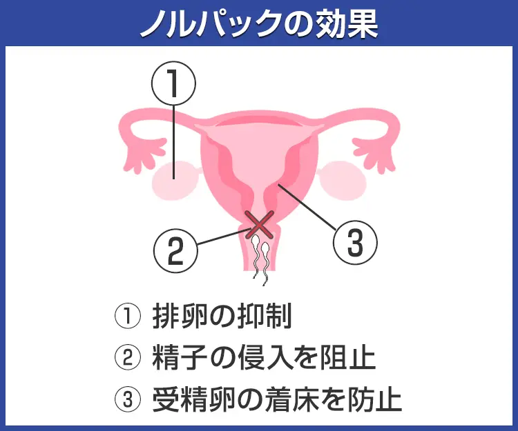 ノルパック3