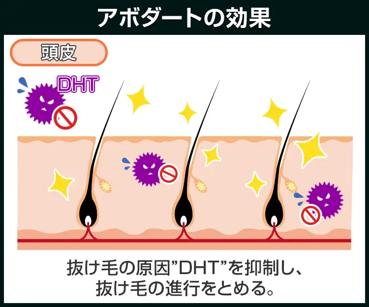 アボダート6