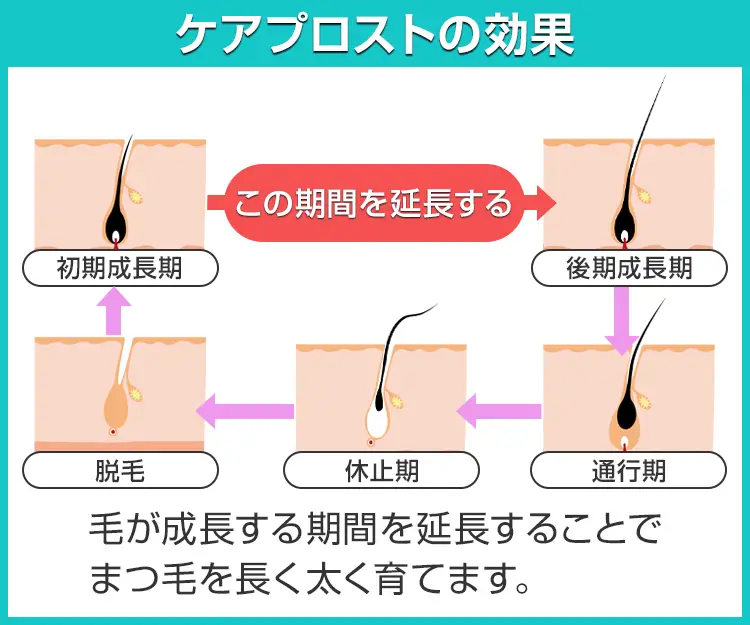 ケアプロスト3