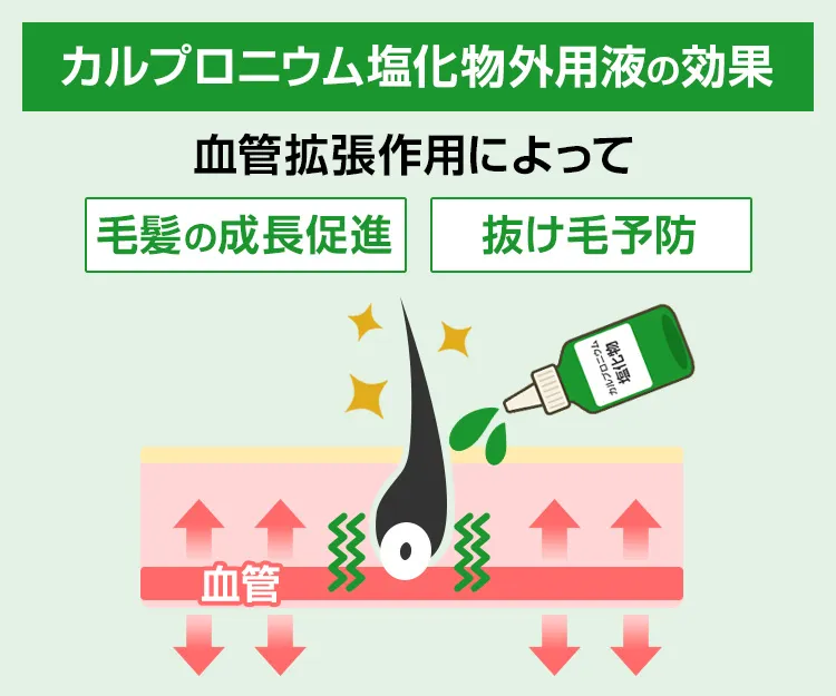 カルプロニウム塩化物外用液3