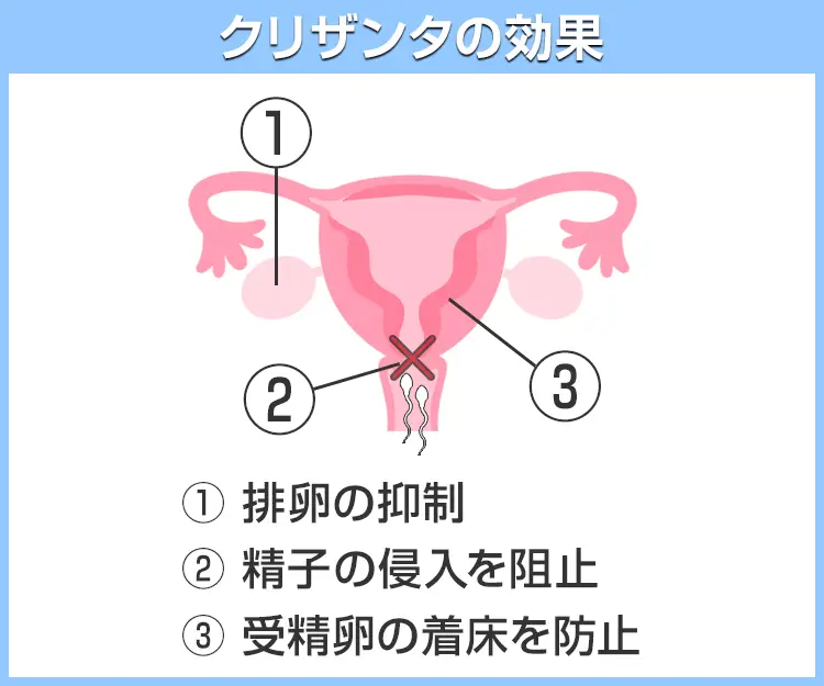 クリザンタ4