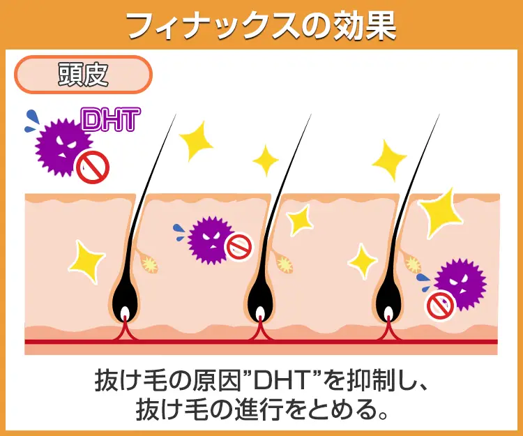 フィナックス6