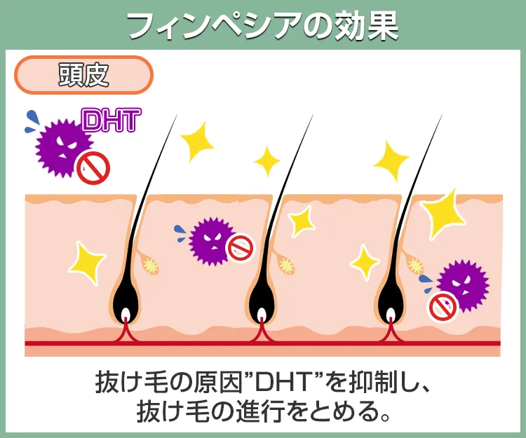 フィンペシア6