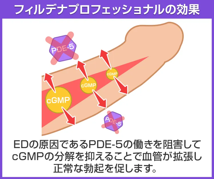 フィルデナプロフェッショナル4