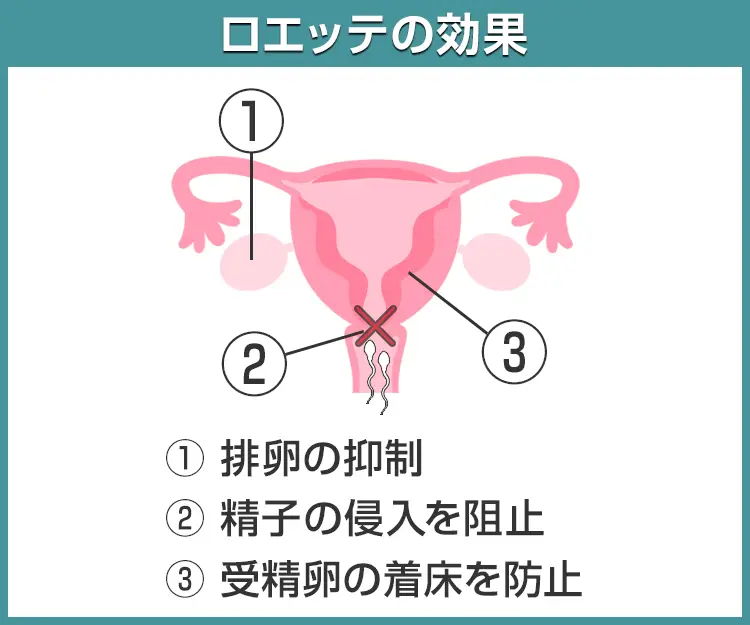 ロエッテ4