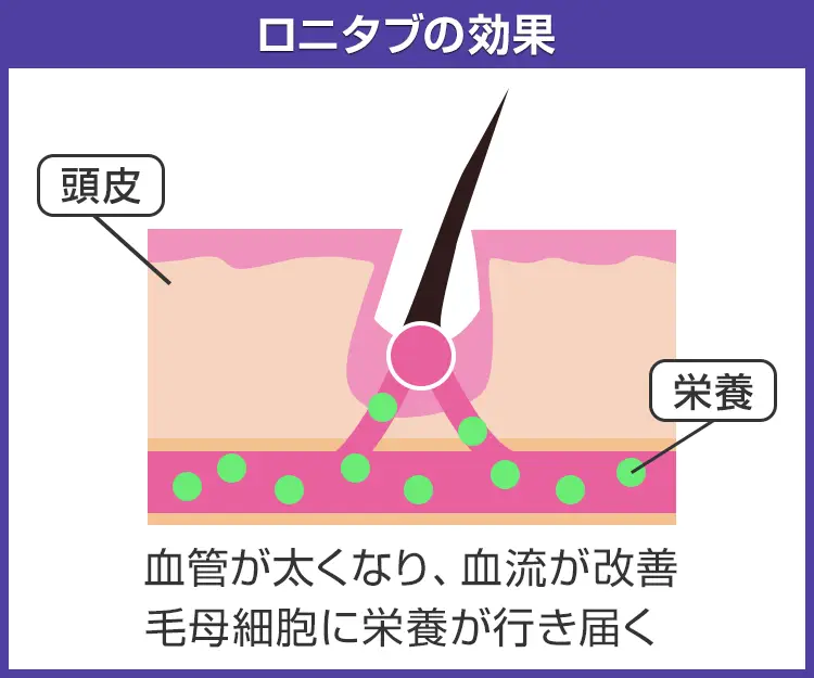 ロニタブ7