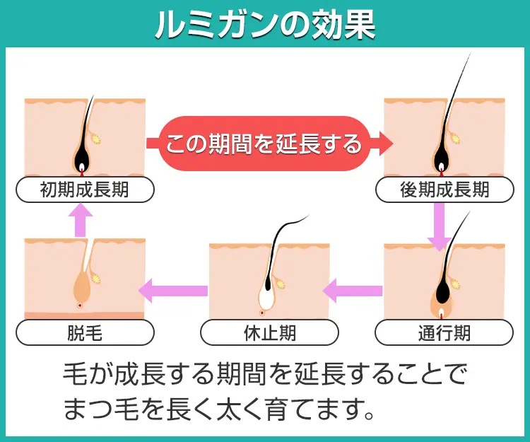 ルミガン6