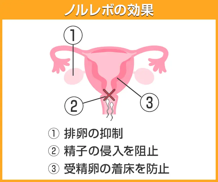 ノルレボ3