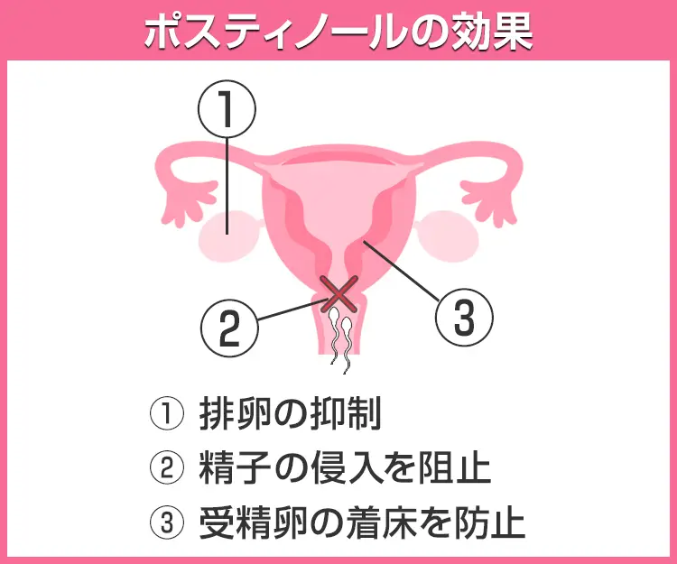 ポスティノール4