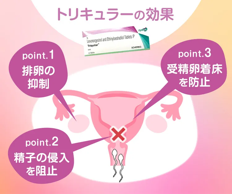 トリキュラー7
