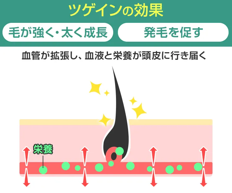 ツゲイン7