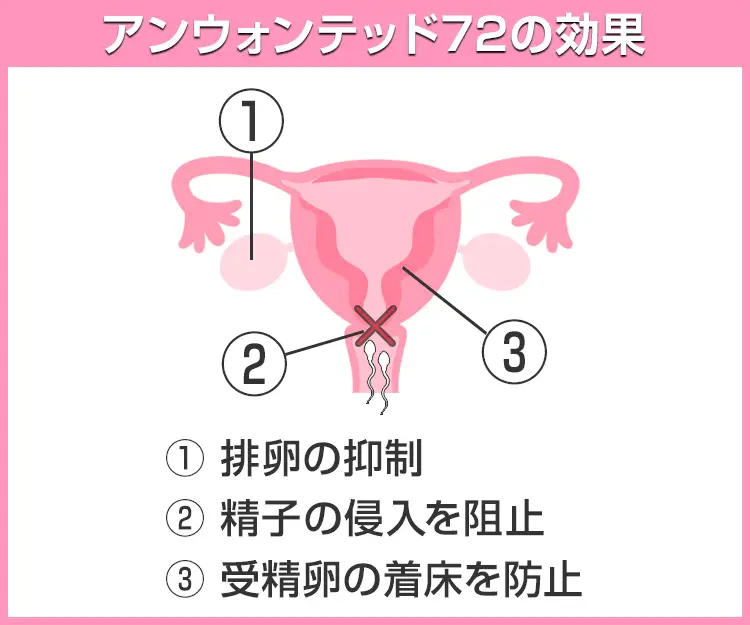 アンウォンテッド726