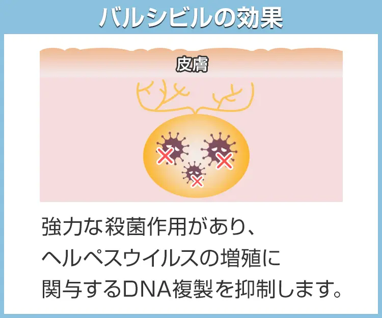 バルシビル4