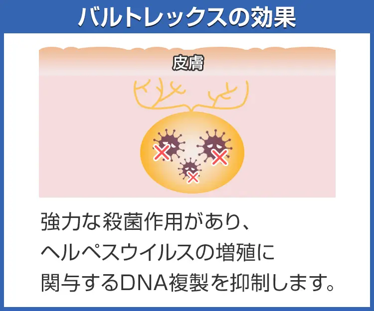 バルトレックス4