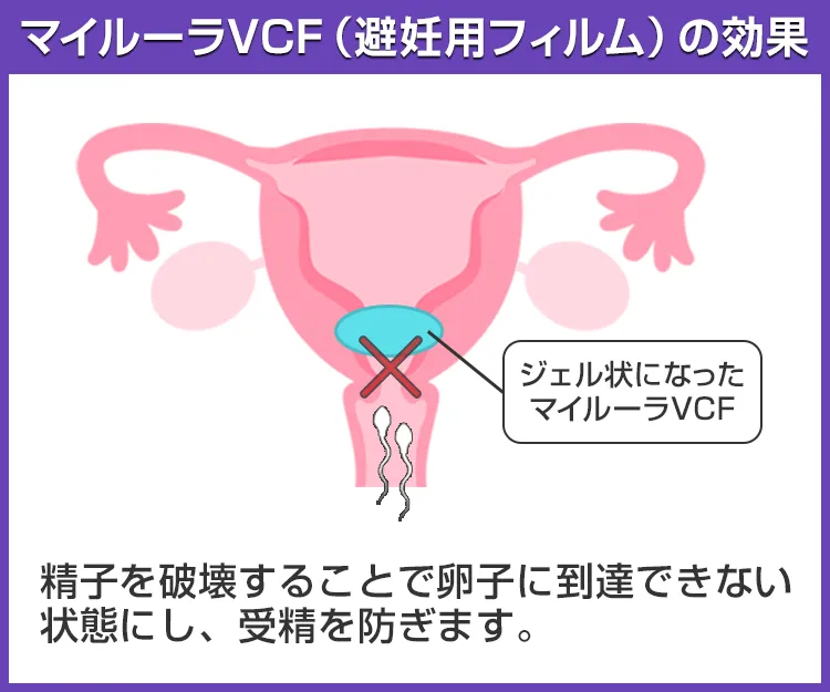 マイルーラVCF（避妊用フィルム）3