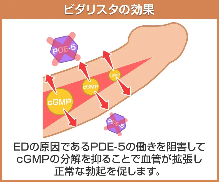 ビダリスタ6