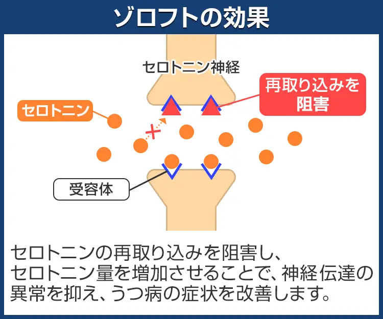 ゾロフト7